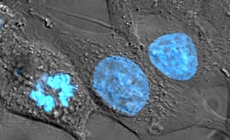 HeLa cells with blue nuclear stain